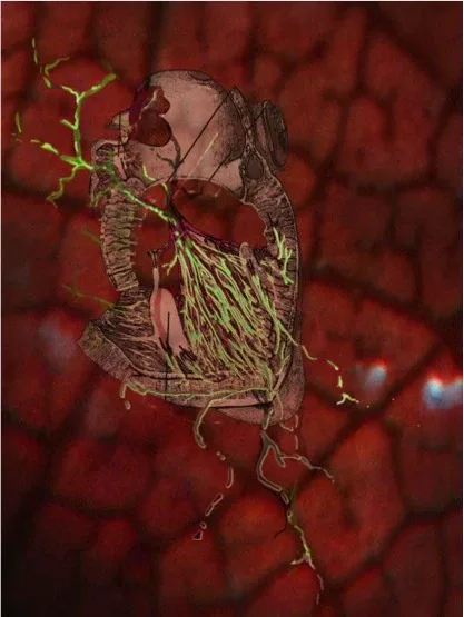 A pale anatomical form with fine branching lines against a red background.